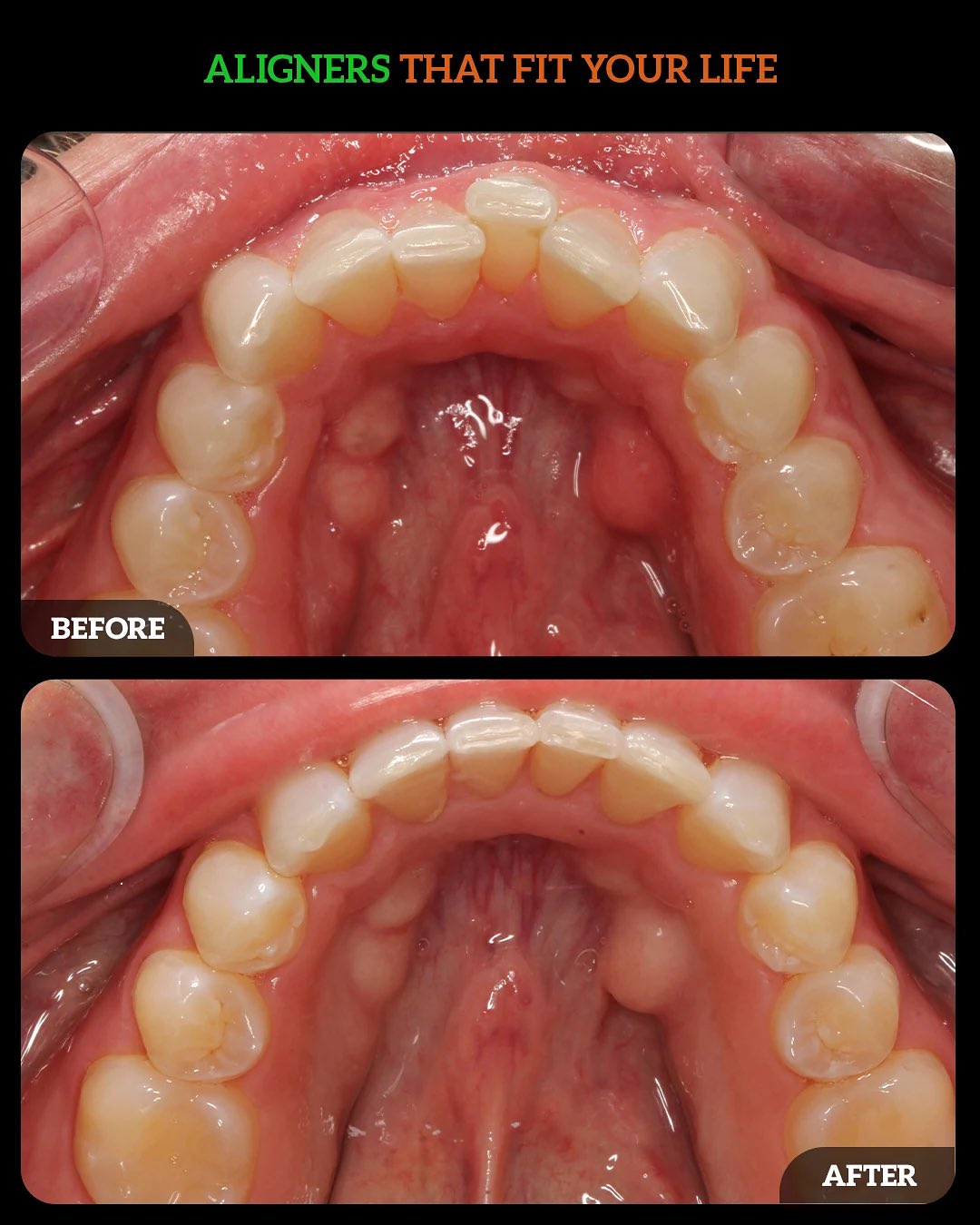 537761294_18528444778010625_6216053810022923300_n