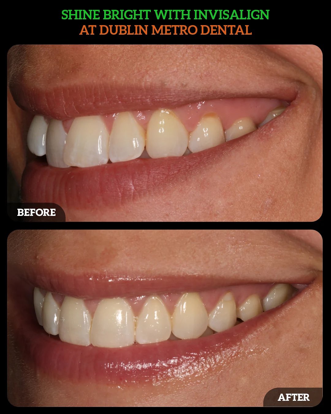 540431282_18529327744010625_8880826222964922028_n