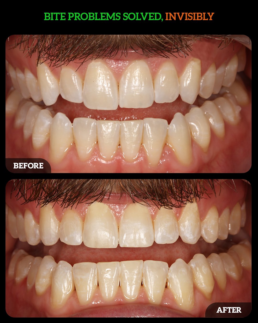 549964089_18532848259010625_6996064199128002621_n