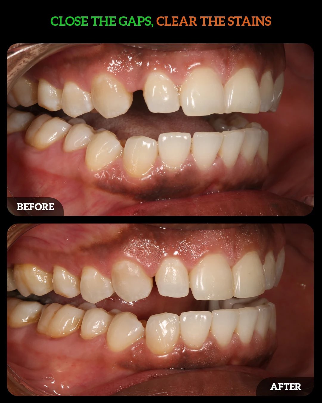 550439725_18533159644010625_3099583073619479807_n