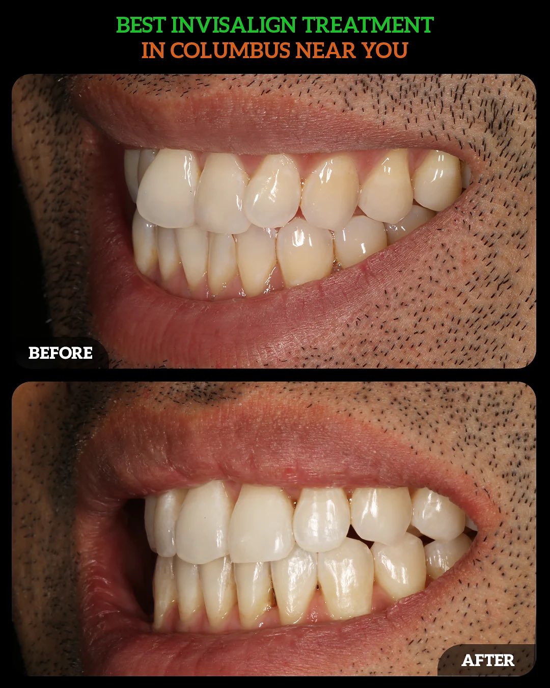 551221227_18533887756010625_1809816264281430189_n