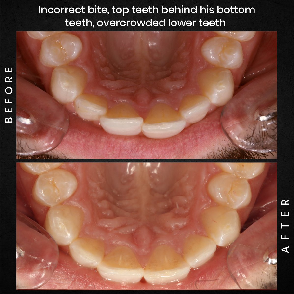 DMD AUG POST 16 B&A CAROUSEL ADAM BARSTOW_2
