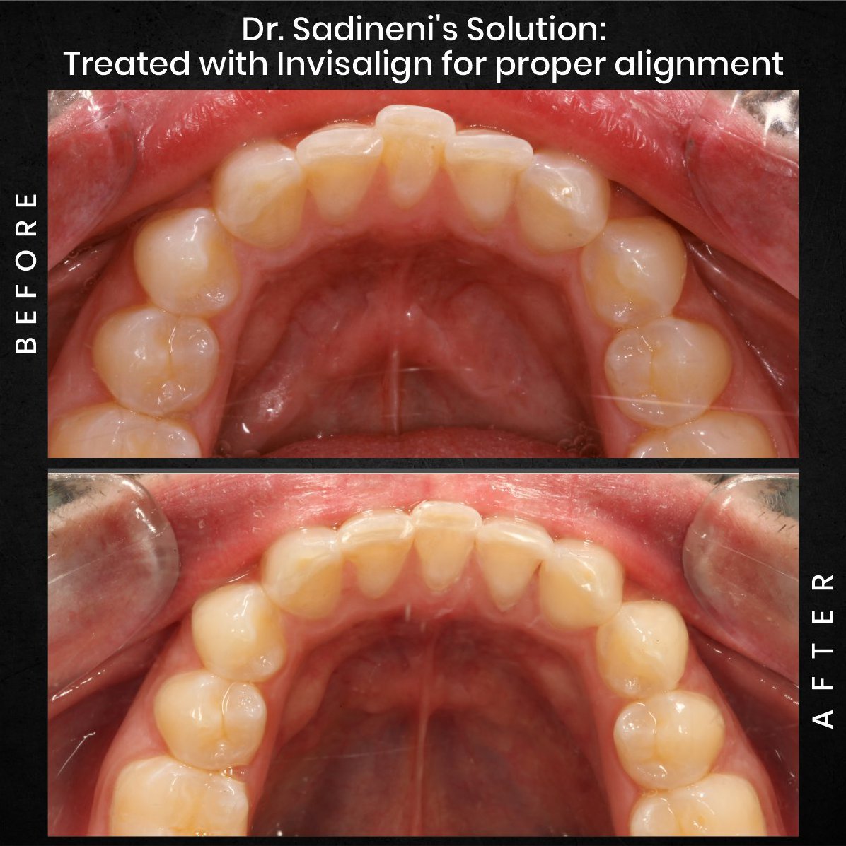 DMD AUG POST 16 B&A CAROUSEL ADAM BARSTOW_3