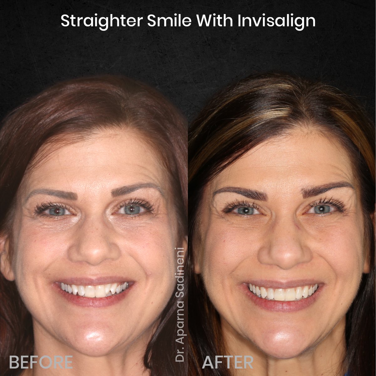 DMD AUG POST 18 B&A CAROUSEL MELISSA CLOSSER_1