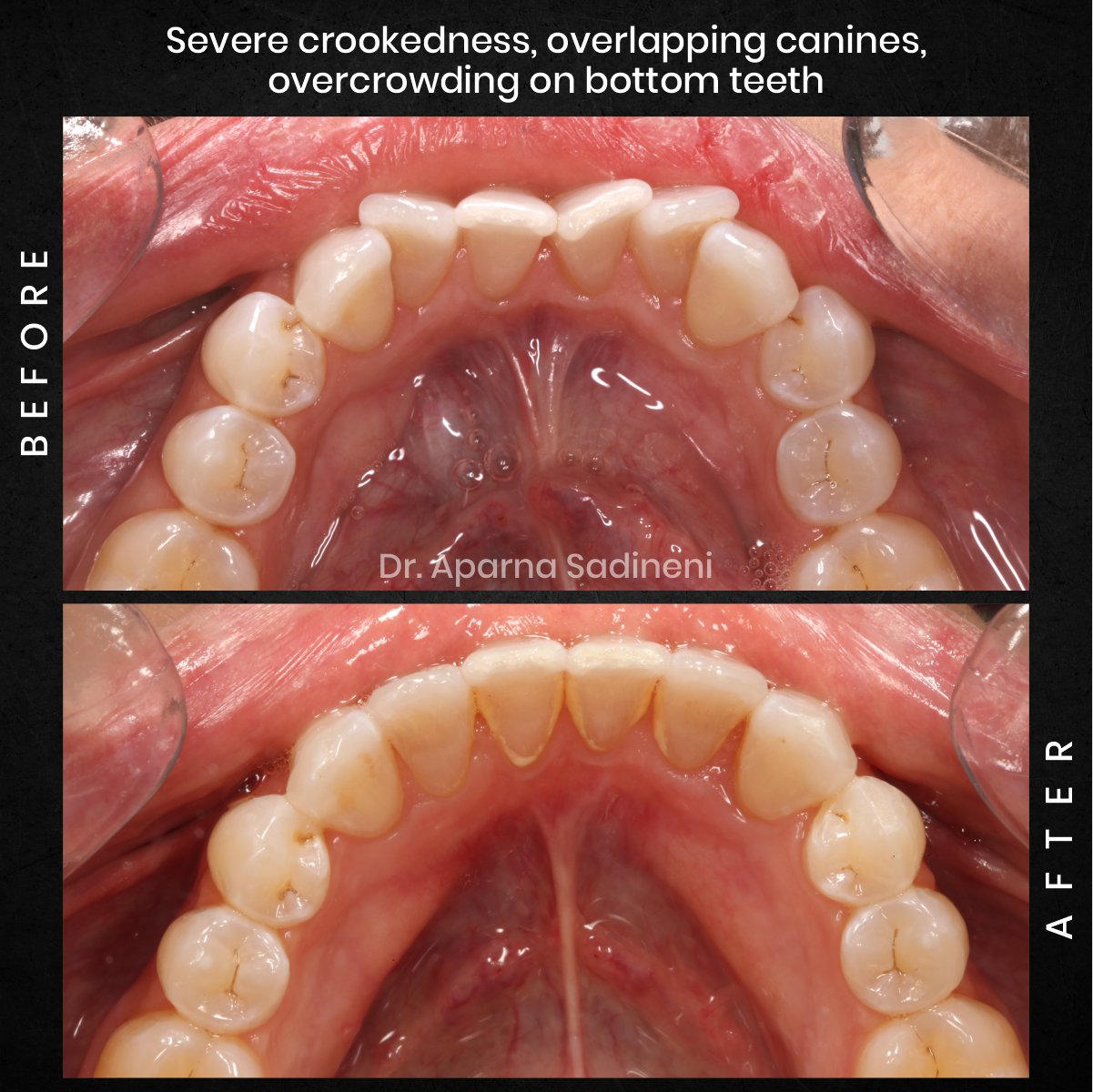 DMD AUG POST 18 B&A CAROUSEL MELISSA CLOSSER_2