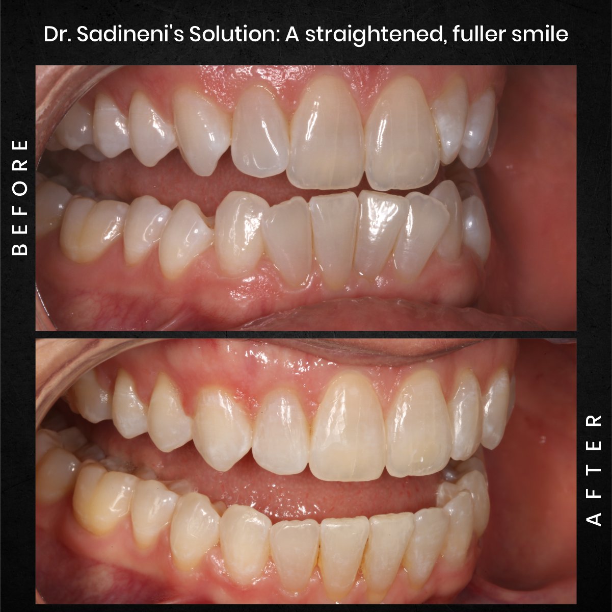 DMD AUG POST 18 B&A CAROUSEL MELISSA CLOSSER_3