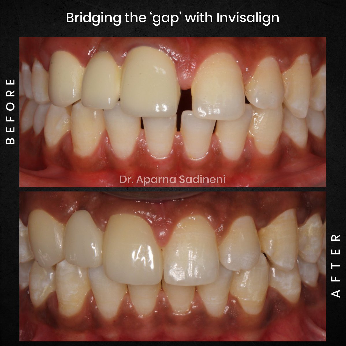 DMD CYCLE 3 POST 1 CAROUSEL B&A BHARATH_1