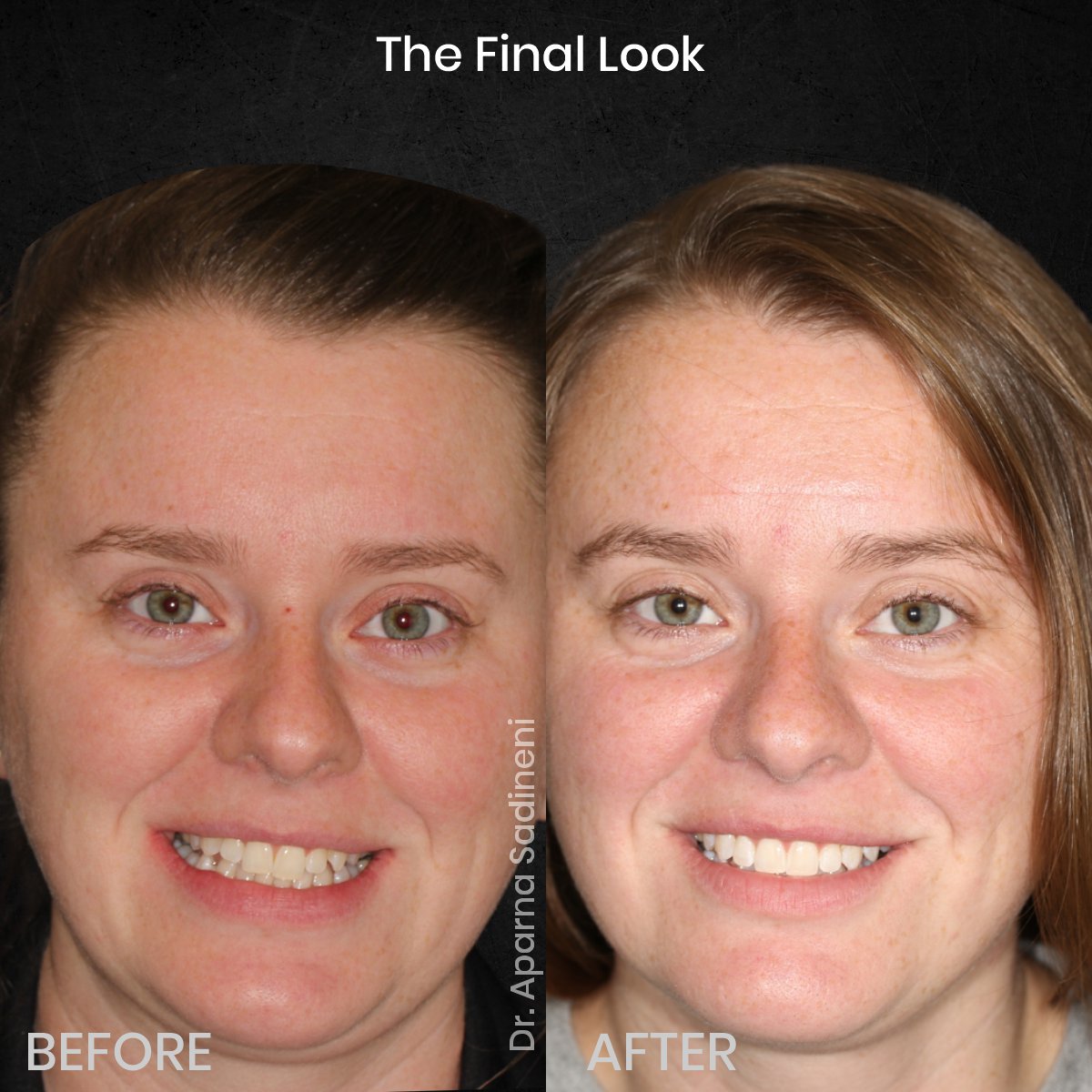 DMD CYCLE 3 POST 3 B&A CAROUSEL AMBER P._4