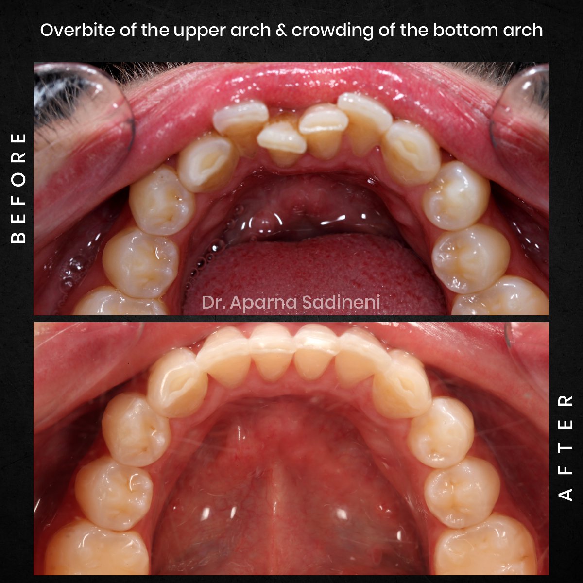 DMD DEC GRID 1 POST 3 HEADSHOT B&A - JOSHUA_2