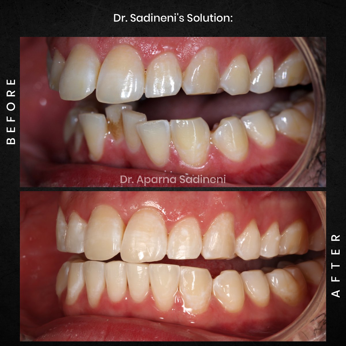 DMD DEC GRID 1 POST 3 HEADSHOT B&A - JOSHUA_3
