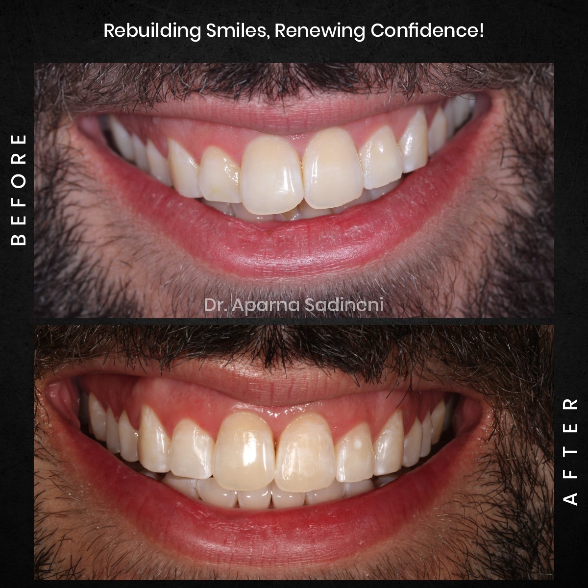 DMD DEC GRID 1 POST 3 HEADSHOT B&A - JOSHUA_6