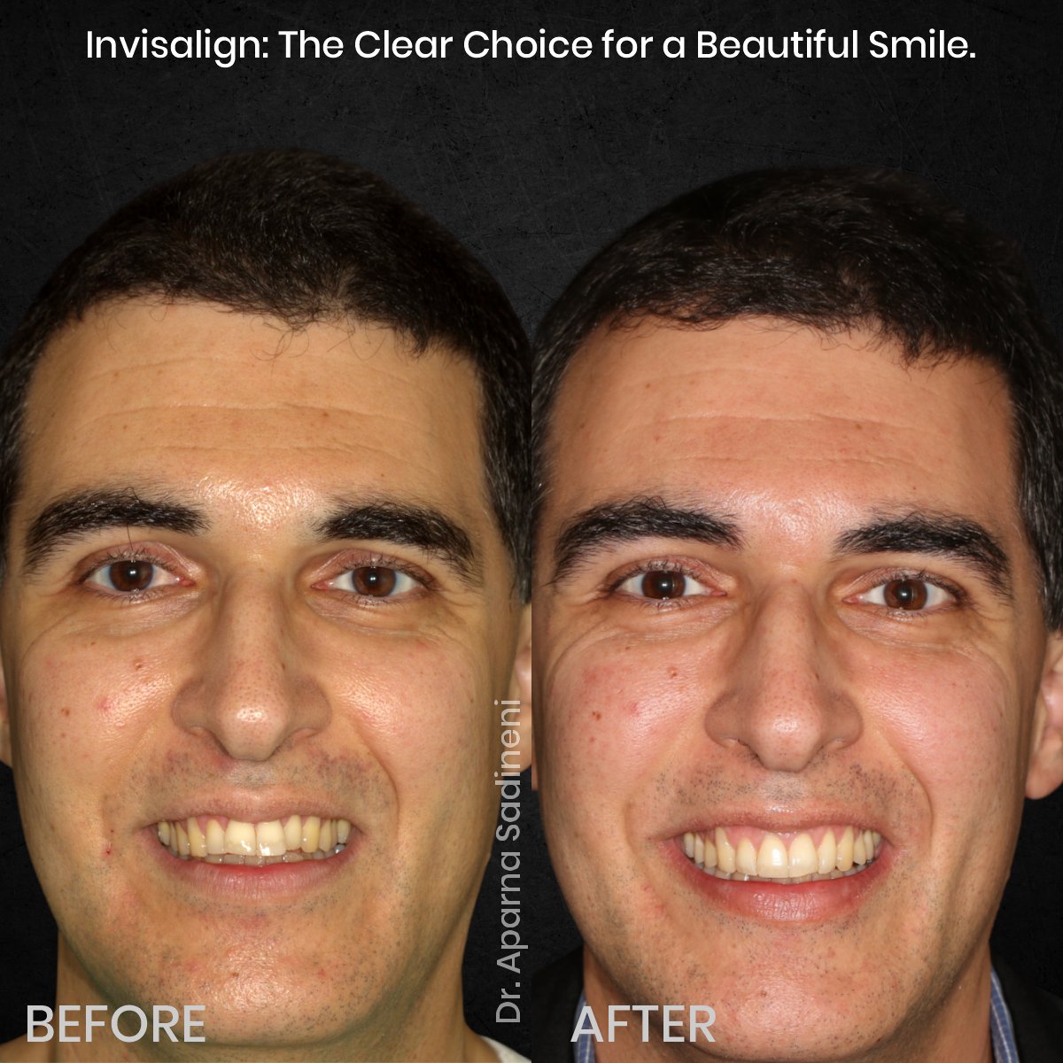 DMD NOV GRID 1 POST 3 - HEADSHOT B&A FRANCESCO_1