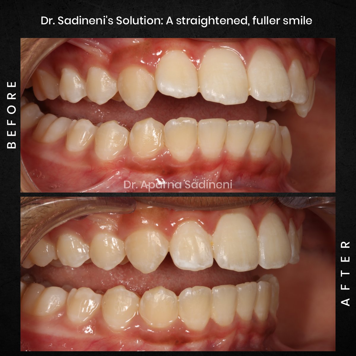 DMD NOV GRID 3 POST 5 - HEADSHOT B_A ARUSH_3 (1)