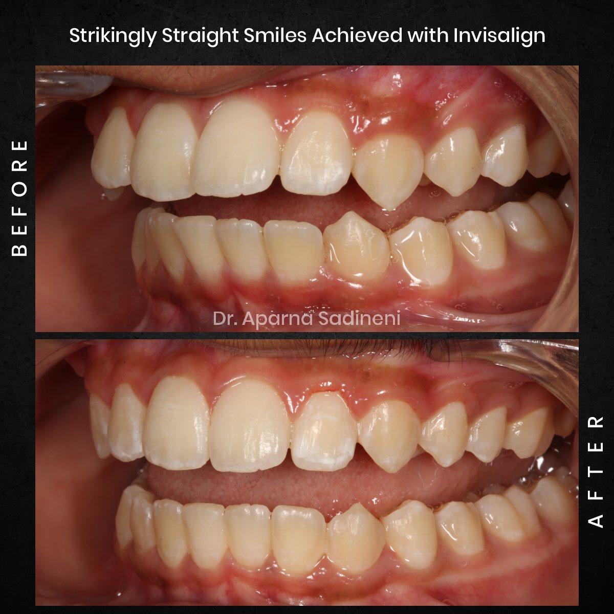 DMD NOV GRID 3 POST 5 - HEADSHOT B_A ARUSH_4 (1)