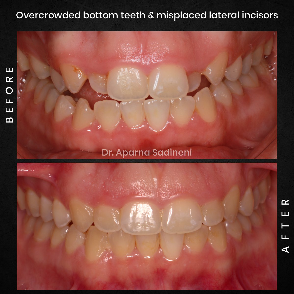 DMD OCT GRID 1 B&A Brianna M_2 (1)