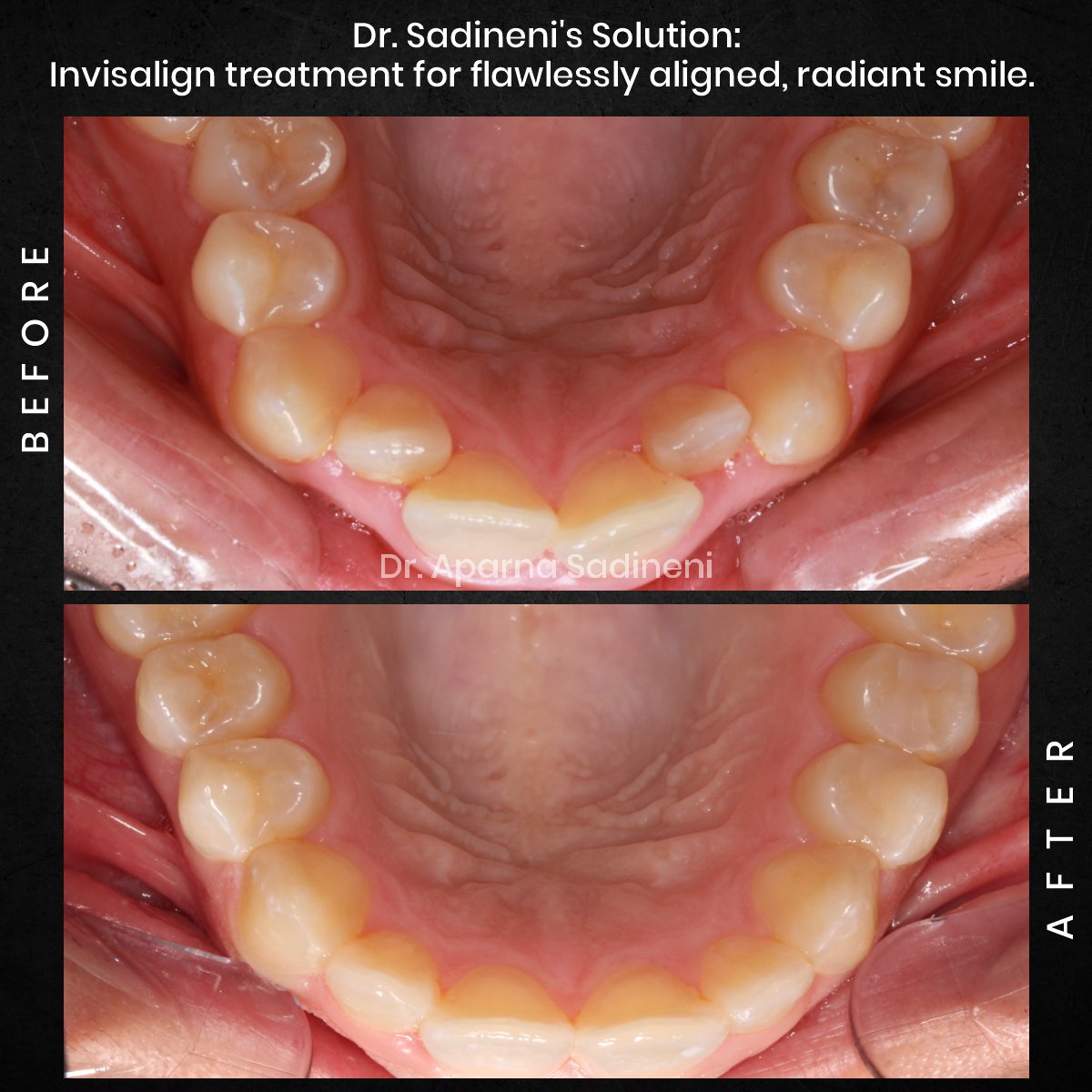 DMD OCT GRID 1 B&A Brianna M_3 (1)