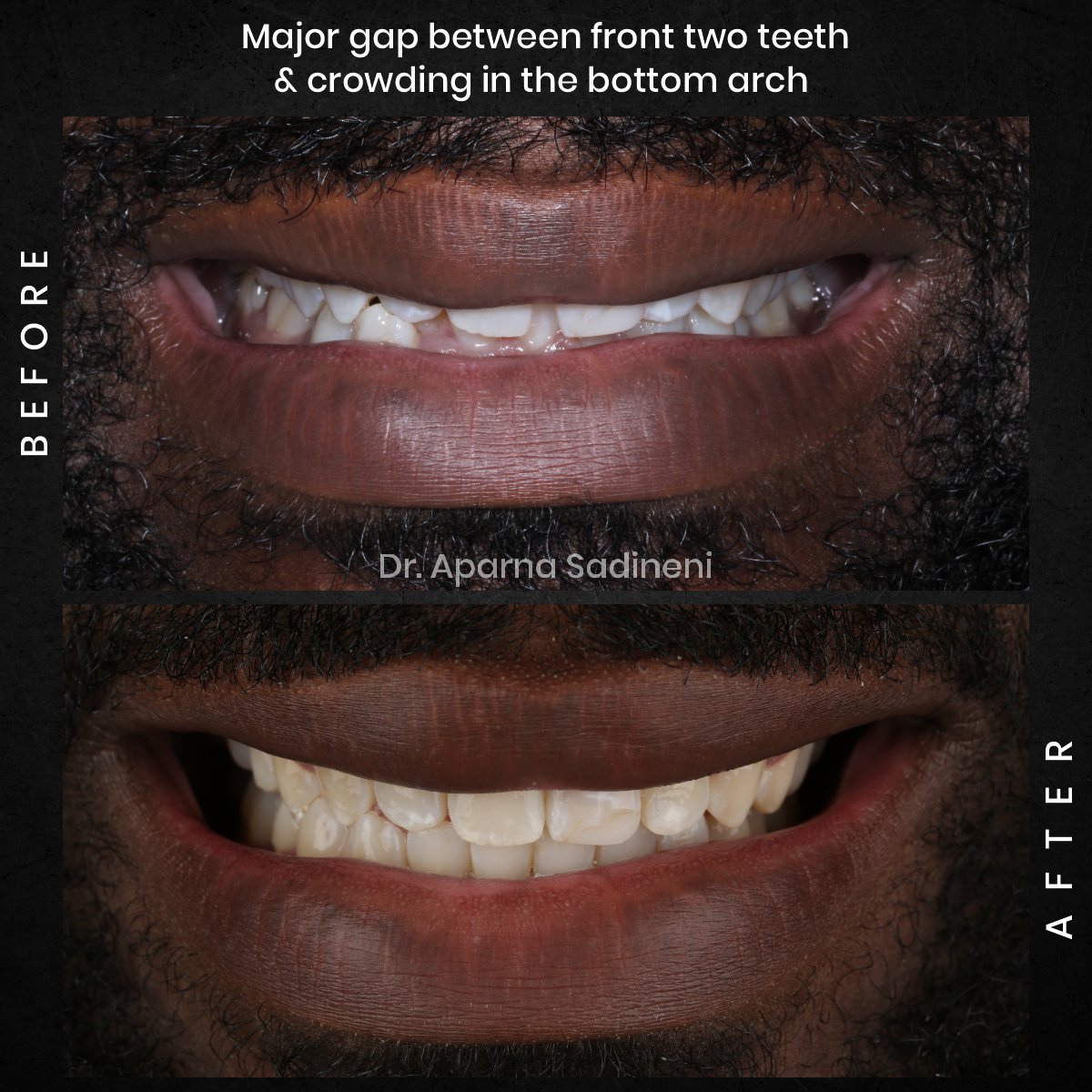 DMD OCT GRID 1 B_A DEARIUS_2