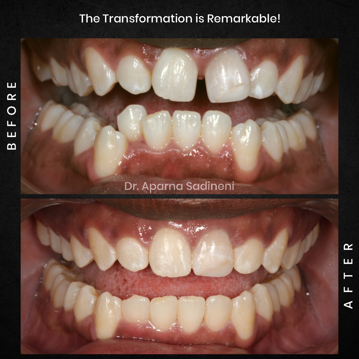 DMD OCT GRID 1 B_A DEARIUS_5