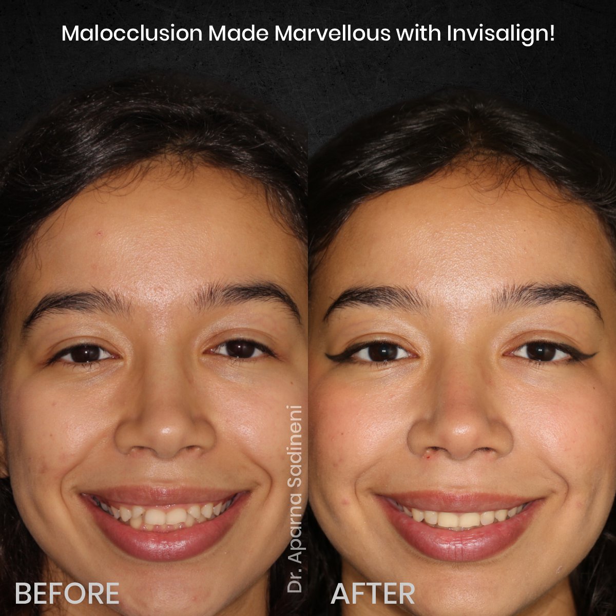 DMD OCT GRID 4 B&A HEADSHOT - MORGANE_1