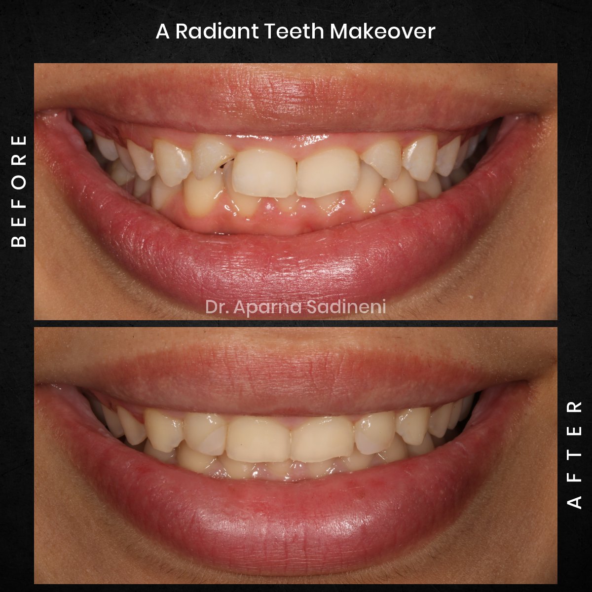 DMD OCT GRID 4 B&A HEADSHOT - MORGANE_5