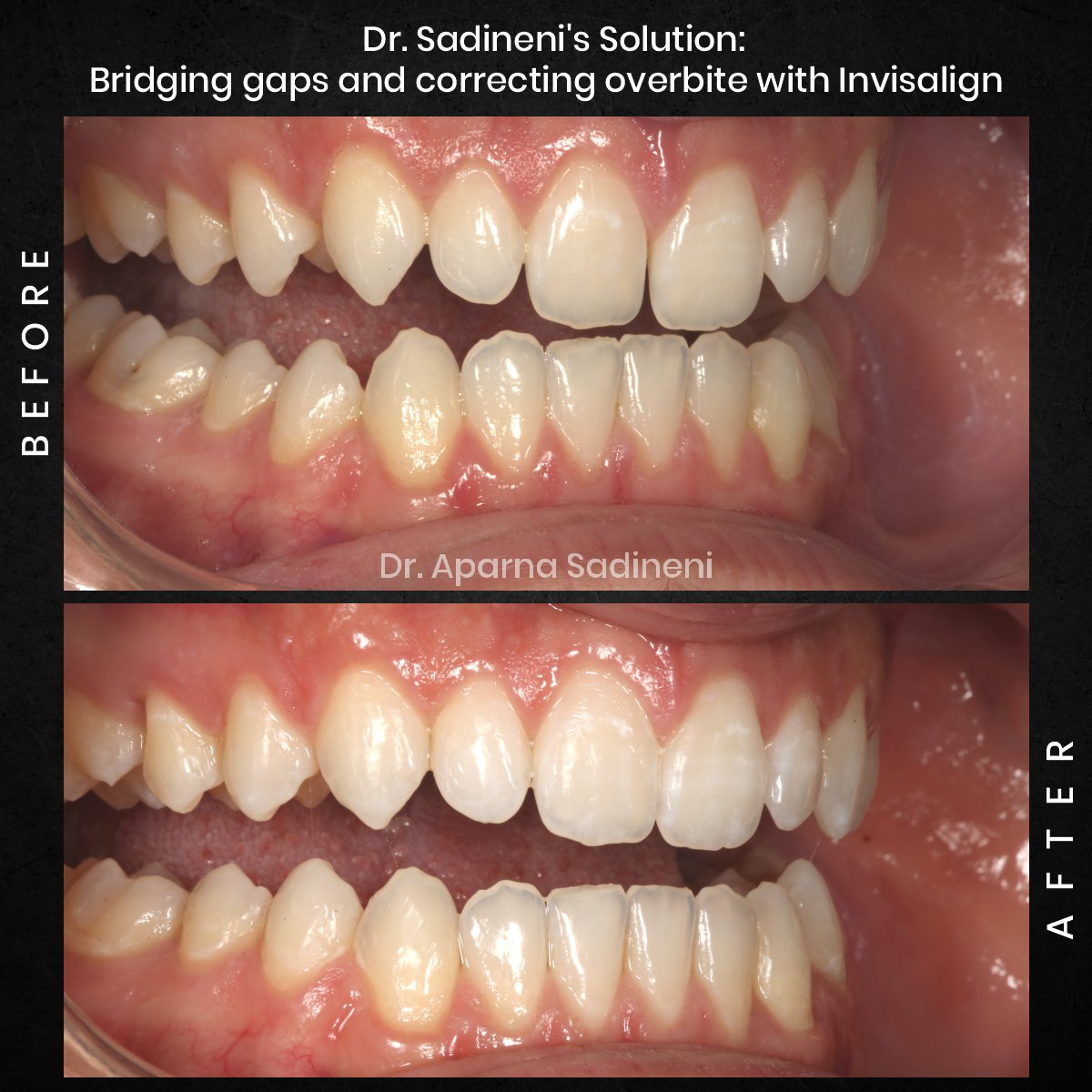 DMD OCT GRID 4 B&A TEETH CAROUSEL - Esam Dobal-3