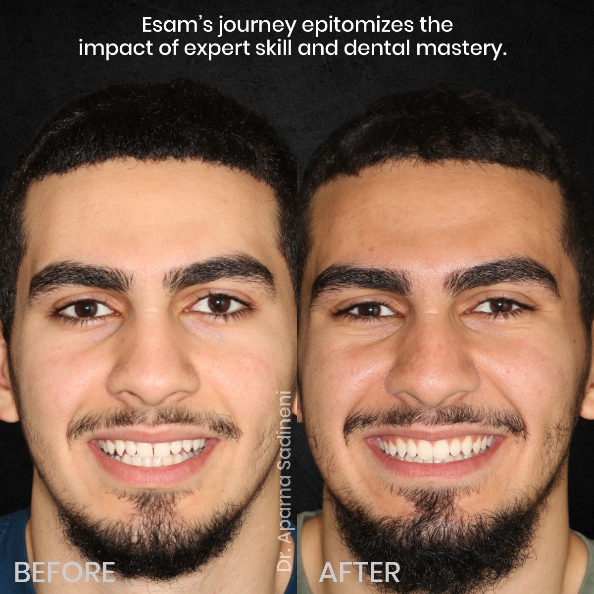 DMD OCT GRID 4 B&A TEETH CAROUSEL - Esam Dobal-5