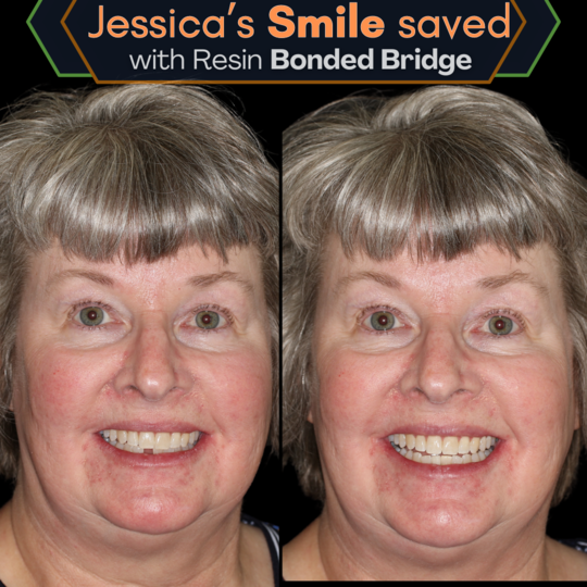 Porcelain Bridge (4)