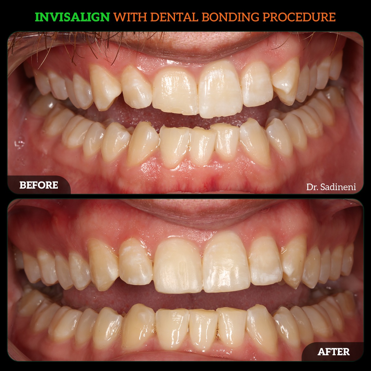 WhatsApp Image 2024-05-23 at 7.04.21 PM (1)